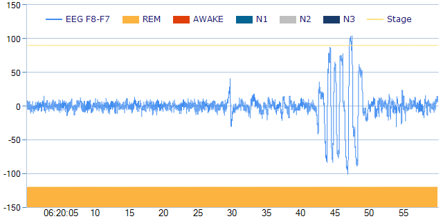 Lucid signal at 06:20