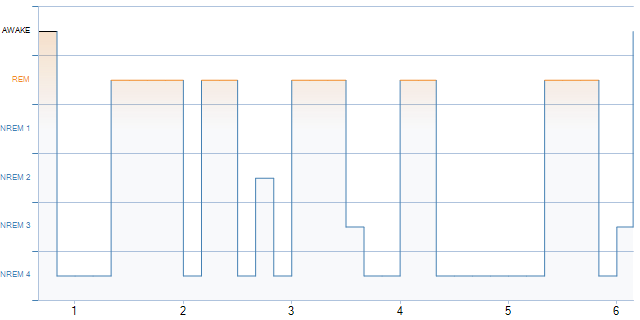 Sideways REM Detection: Hypnogram